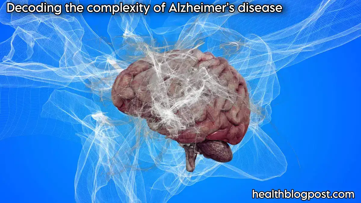 Decoding the complexity of Alzheimer's disease