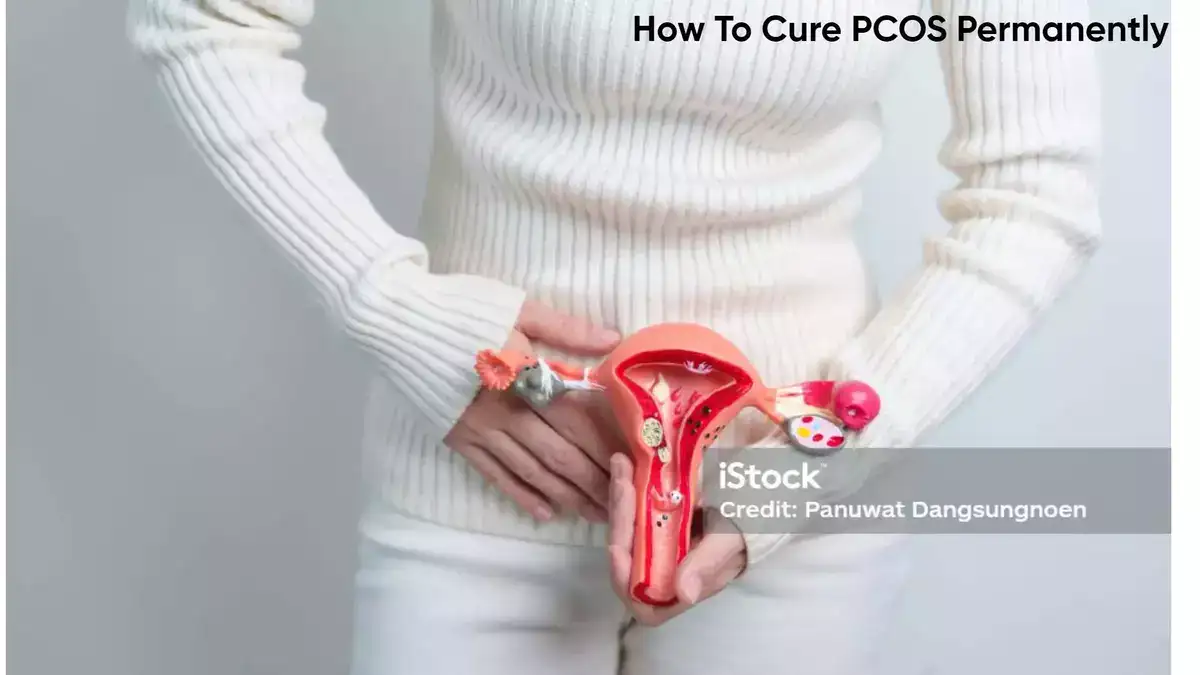 How To Cure PCOS Permanently